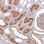 Merck Anti-ALDH3B1 antibody produced in rabbit
