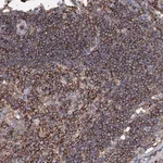 Merck Anti-UBASH3B antibody produced in rabbit