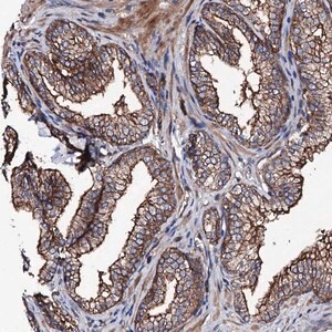Merck Anti-TBCEL antibody produced in rabbit