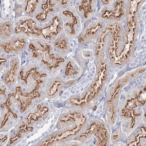 Merck Anti-CCDC73 antibody produced in rabbit