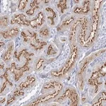 Merck Anti-CCDC73 antibody produced in rabbit