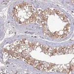 Merck Anti-DENND5B antibody produced in rabbit