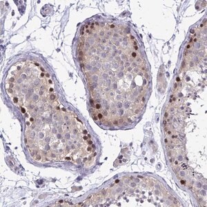 Merck Anti-ZBTB25 antibody produced in rabbit