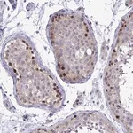 Merck Anti-ZBTB25 antibody produced in rabbit
