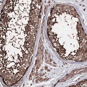 Merck Anti-ZNF662 antibody produced in rabbit