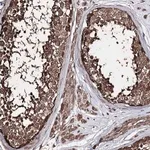 Merck Anti-ZNF662 antibody produced in rabbit