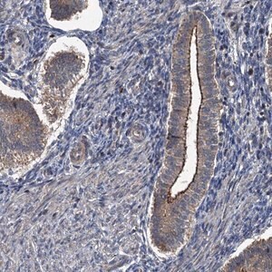 Merck Anti-N4BP2L2 antibody produced in rabbit