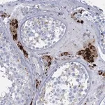 Merck Anti-TRIM77 antibody produced in rabbit
