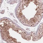 Merck Anti-CCNI antibody produced in rabbit