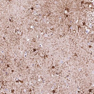 Merck Anti-RARS2 antibody produced in rabbit
