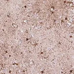 Merck Anti-RARS2 antibody produced in rabbit
