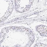 Merck Anti-TPSD1 antibody produced in rabbit