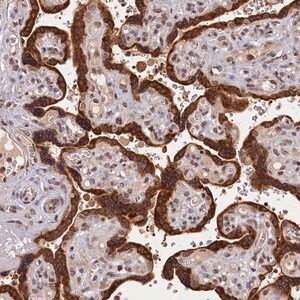 Merck Anti-KCNK6 antibody produced in rabbit