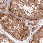 Merck Anti-MMP15 antibody produced in rabbit