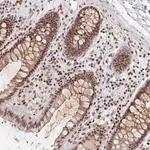 Merck Anti-H1FX antibody produced in rabbit