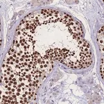 Merck Anti-ZNF662 antibody produced in rabbit