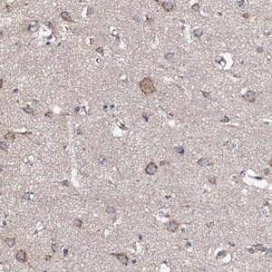 Merck Anti-GLCE antibody produced in rabbit