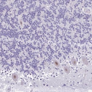 Merck Anti-GLB1L2 antibody produced in rabbit