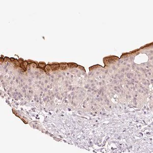 Merck Anti-SLC29A3 antibody produced in rabbit