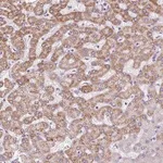 Merck Anti-TMEM170A antibody produced in rabbit