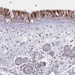 Merck Anti-VWC2 antibody produced in rabbit