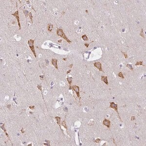 Merck Anti-ZFYVE26 antibody produced in rabbit