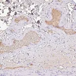 Merck Anti-HOXC12 antibody produced in rabbit