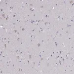 Merck Anti-NOXRED1 antibody produced in rabbit