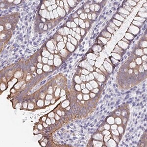 Merck Anti-UNKL antibody produced in rabbit