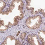 Merck Anti-HDHD2 antibody produced in rabbit
