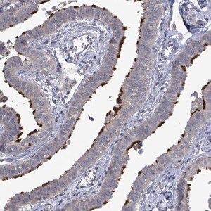 Merck Anti-POMGNT2 antibody produced in rabbit