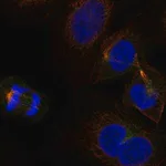 Merck Anti-KLHL22 antibody produced in rabbit