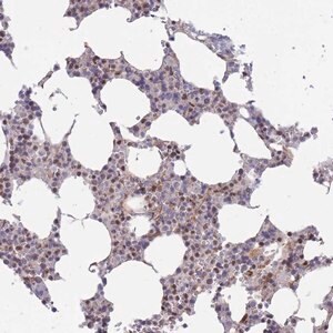 Merck Anti-BOD1L1 antibody produced in rabbit