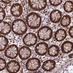 Merck Anti-ZNF428 antibody produced in rabbit