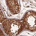 Merck Anti-RALGAPA2 antibody produced in rabbit