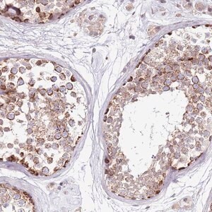 Merck Anti-RARS2 antibody produced in rabbit