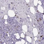 Merck Anti-KMT2E antibody produced in rabbit