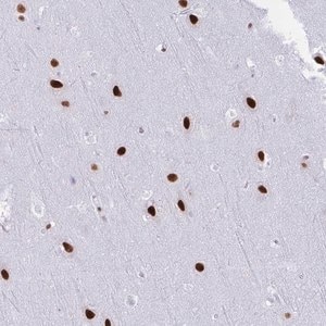 Merck Anti-DDX52 antibody produced in rabbit