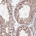 Merck Anti-JMJD1C antibody produced in rabbit