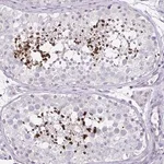 Merck Anti-D2HGDH antibody produced in rabbit