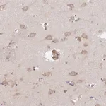 Merck Anti-TMEM229A antibody produced in rabbit