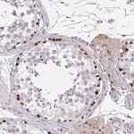 Merck Anti-RHOXF1 antibody produced in rabbit