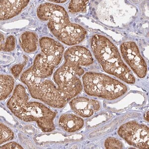 Merck Anti-L3HYPDH antibody produced in rabbit