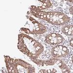 Merck Anti-NT5C1B antibody produced in rabbit