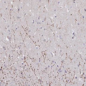 Merck Anti-ARPP19 antibody produced in rabbit