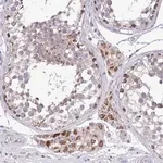 Merck Anti-SARS2 antibody produced in rabbit