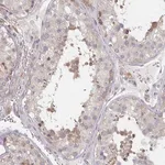 Merck Anti-PSMG1 antibody produced in rabbit