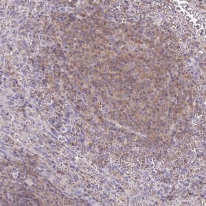 Merck Anti-TNFAIP8 antibody produced in rabbit