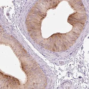 Merck Anti-VPS25 antibody produced in rabbit