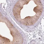 Merck Anti-VPS25 antibody produced in rabbit